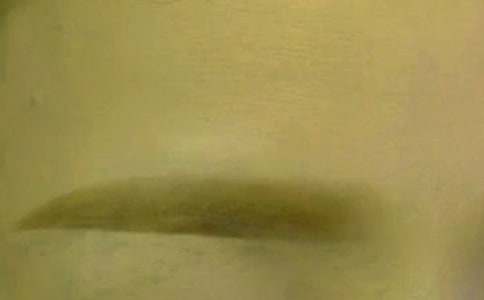 �茑�˵�üë�ĺ��~�þ�