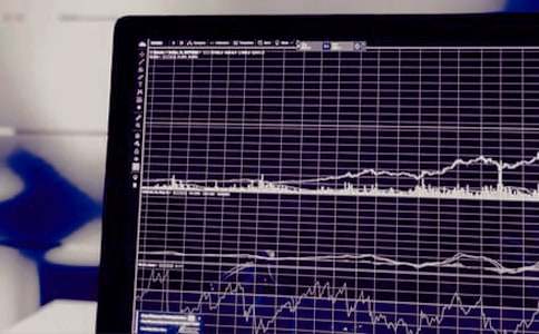 證券從業(yè)考點:股份制改組